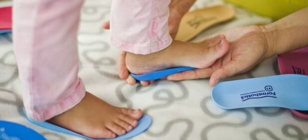Insoles with valgus deformation of the foot in children